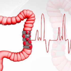 直肠癌的基本症状都有什么？