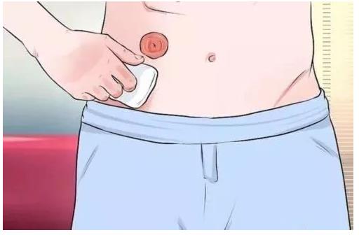 带你正确认识”造口袋“(图3)